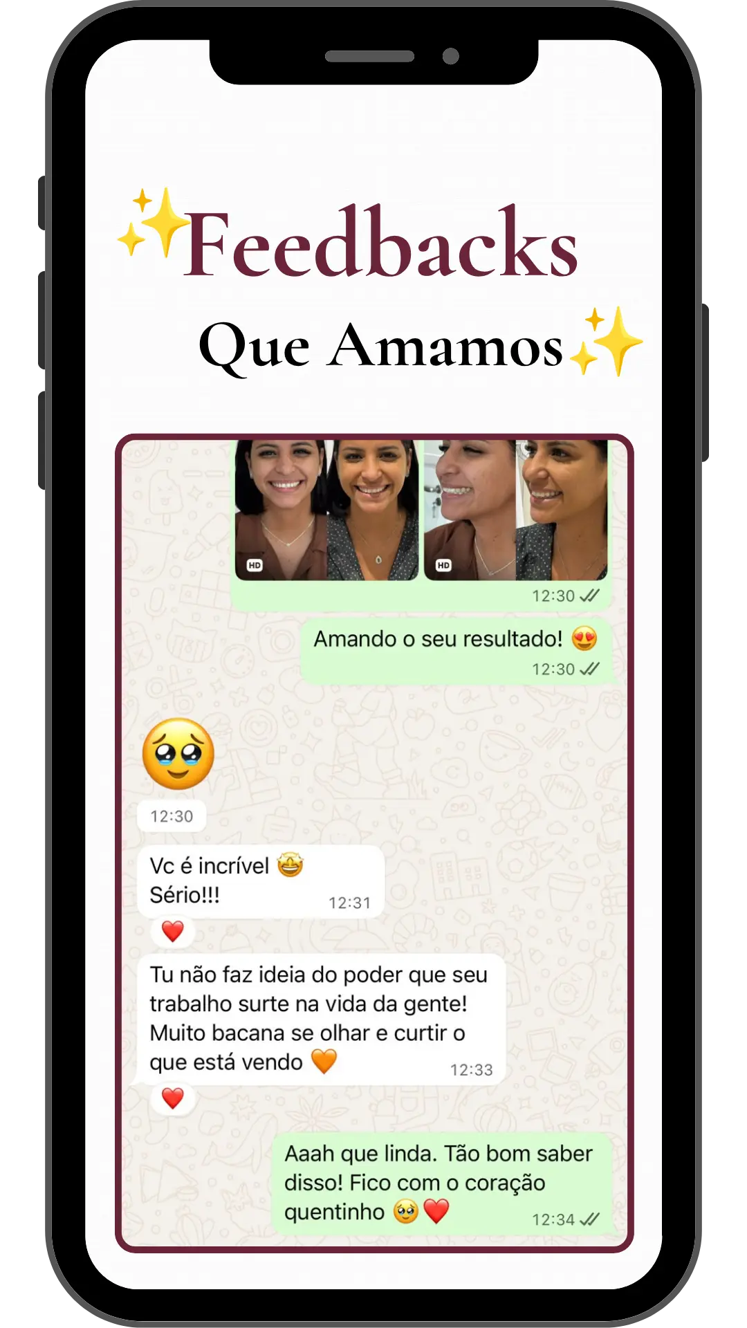 relato harmonização facial em niterói